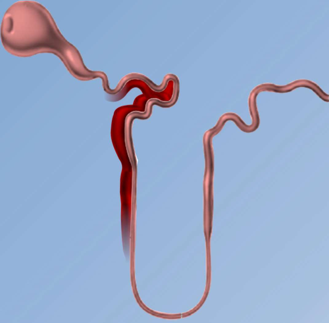 Bakris GL, et al. Kidney Int.