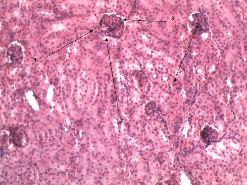 Tvorba moči Moč vzniká v nefronech v několika krocích. Nejdříve dochází k filtraci v glomerulech.