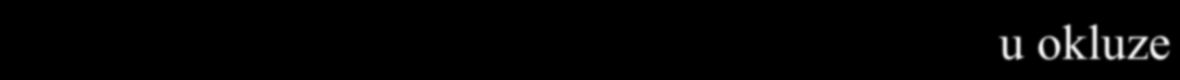 Doporučení pro léčbu ischemické CMP (ESO, 2009, Standard ČR, 2012) Terapie akutní ischemické CMP: - Trombolýza - systémová