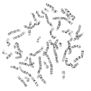 negativní pruhy obsahují sulfhydrylové proteiny (Jarošová, 2000a). Aby byly pruhy jasně viditelné, musí dojít ke kondenzaci chromozómů. Právě proto jsou chromozómy pozorovány v metafázi.