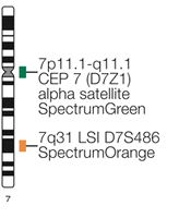 Obr. 9 Ideogram chromozómu 5 a vizualizace oblastí, na které se váže sonda (Kreatech, 2014) LSI sonda 7q31/CEP 7 (Abbott Molecular) hybridizuje k chromozómu 7 taktéž ve dvou oblastech.