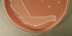 kmenů (typovýkmen) 70% avyšší DNA-DNAhomologie 16SrDNA jevyšší