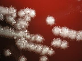 - tři fenotypová oddělení (G-; G+; 0) -dávalo představu o diverzitě bakterií - nebralo vúvahu chemotaxonomii, molekulární taxonomii, fylogenetické vztahy Bakterie = nejpočetnější biotická složka