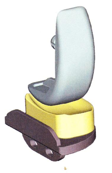 1: Unikondylární cementovaná náhrada kolenního kloubu