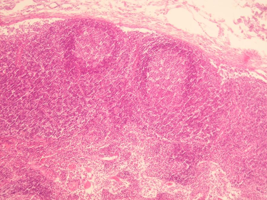 Lymfatická uzlina Vasa afferentia Cortex: Subkapsulární (marginální) sinus Lymfatické folikuly (B dependentní oblast)