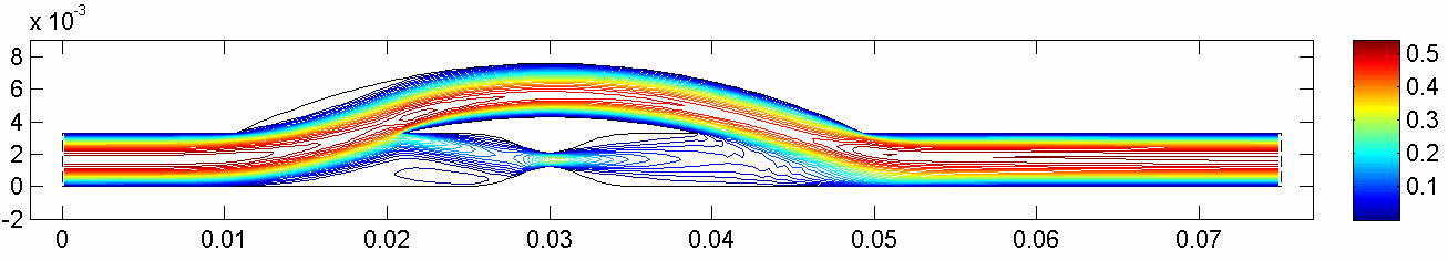 D koronární bypass se stenózo (Re=30, D=6,8mm, α=0 )