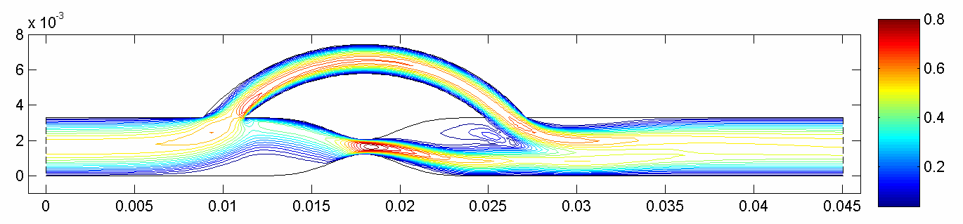 D koronární bypass se stenózo (Re=30, D=6,8mm, α=0, d(št