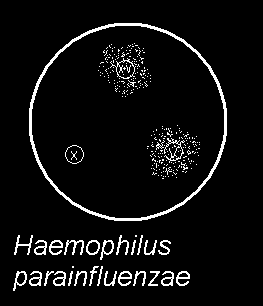 Úkol 3b: Test růstových faktorů hemofilů Jeden