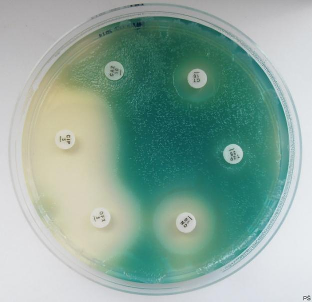 6b Tabulka zón citlivosti pseudomonáda Antibiotikum Zkratka Referenč.