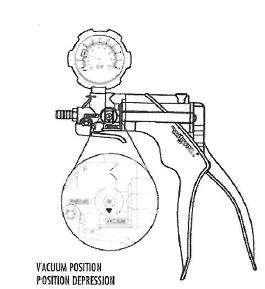 FUNKCIA PUMPY Pozícia vákua Ručná vákuová pumpa je vybavená obtokom, ktorý umožnuje, aby mohol byť použitý aj v tlakovej aj vo vákuovej pozícií.