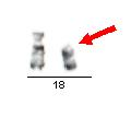 28 Vzory chromosomů s G-pruhy (ISCN 1995) Reálné