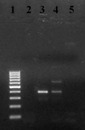 První enzym degradační dráhy HCH - dehydrochlorinasa Primery navrženy pro rod Sphingobium primery: FwlinA2 a RevlinA2 U jednotlivých izolátů nebyl tento gen detekován Gen lin A byl detekován v