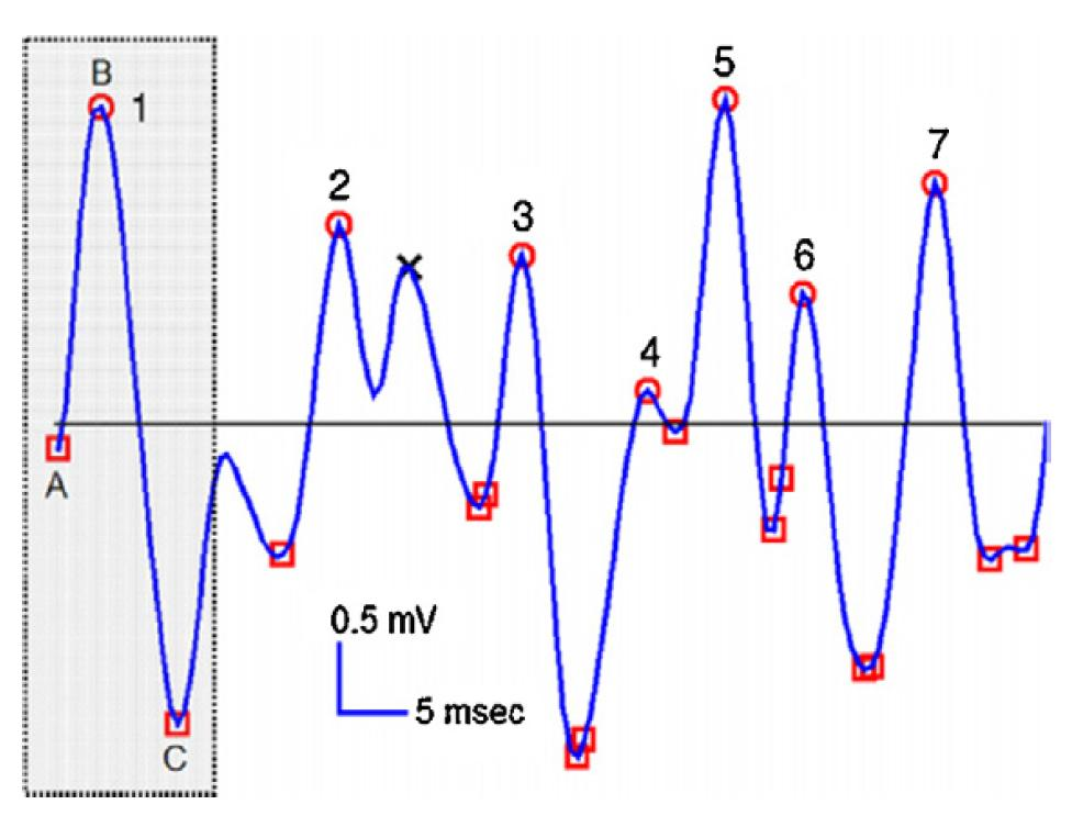 8 ANALÝZA A ZPRACOVÁNÍ SIGNÁLU Při zpracování signálu z povrchového EMG byly použity dva základní přístupy.