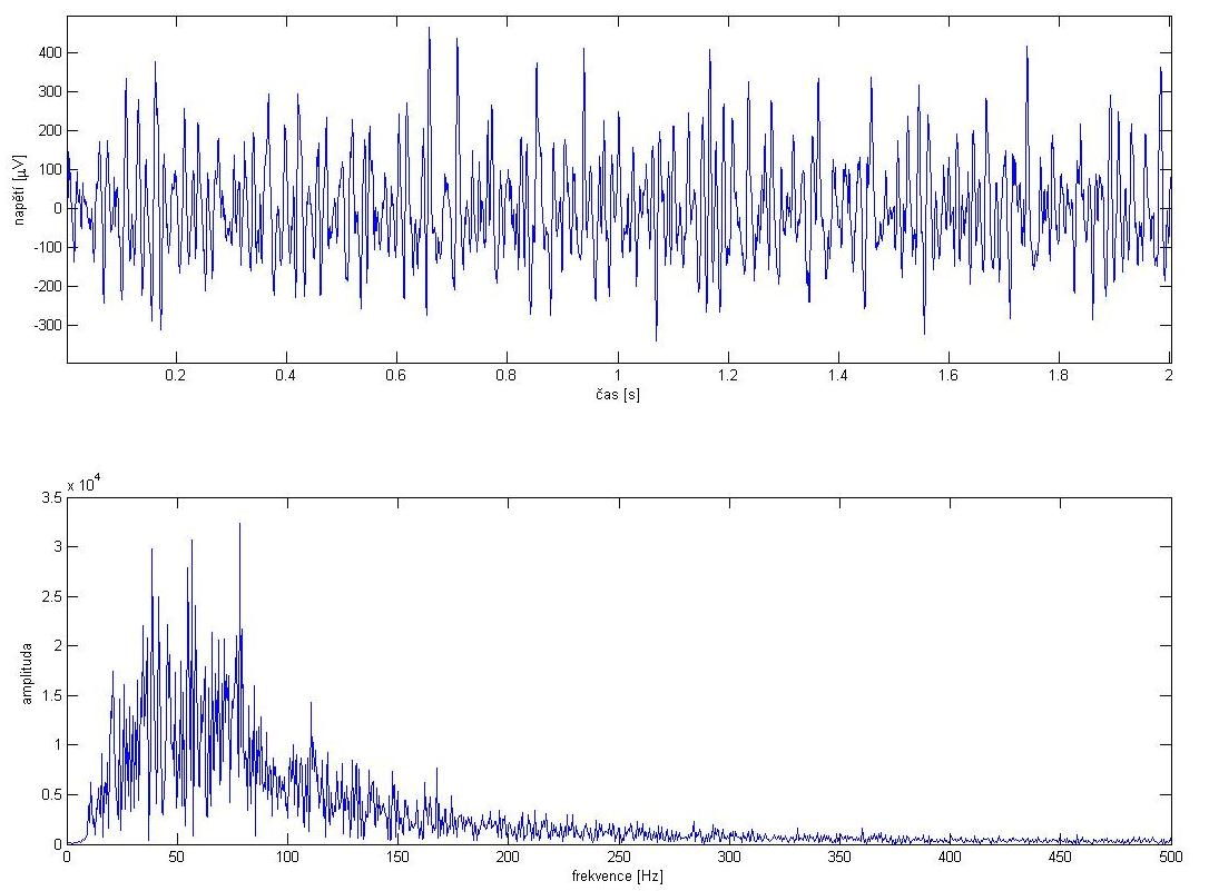 Obrázek 9 Ukázka EMG signálu a jeho frekvenčního spektra Výkonové