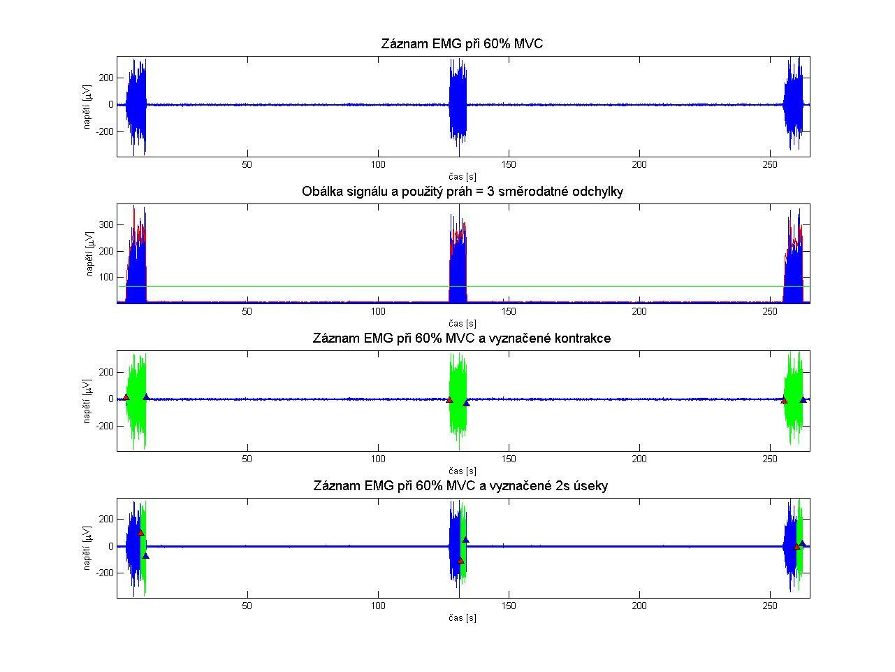 Obrázek 16 Ukázka výběru 2s úseku z EMG signálu.