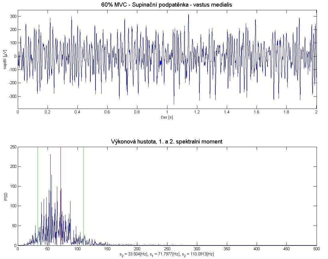 svislou čárou. Dále je uvedena vizualizace výkonové hustoty s vyznačeným a spektrálním momentem (Obr.