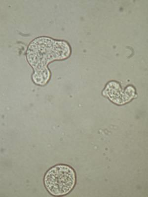 Entamoeba