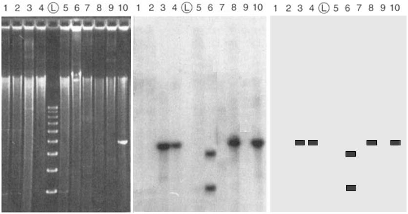 Historie 1975 SOUTHERN přenos fragmentů DNA z agarozového gelu na nitrocelulosovou membránu pomocí kapilárních sil (hybridizace s radioaktivní RNA a