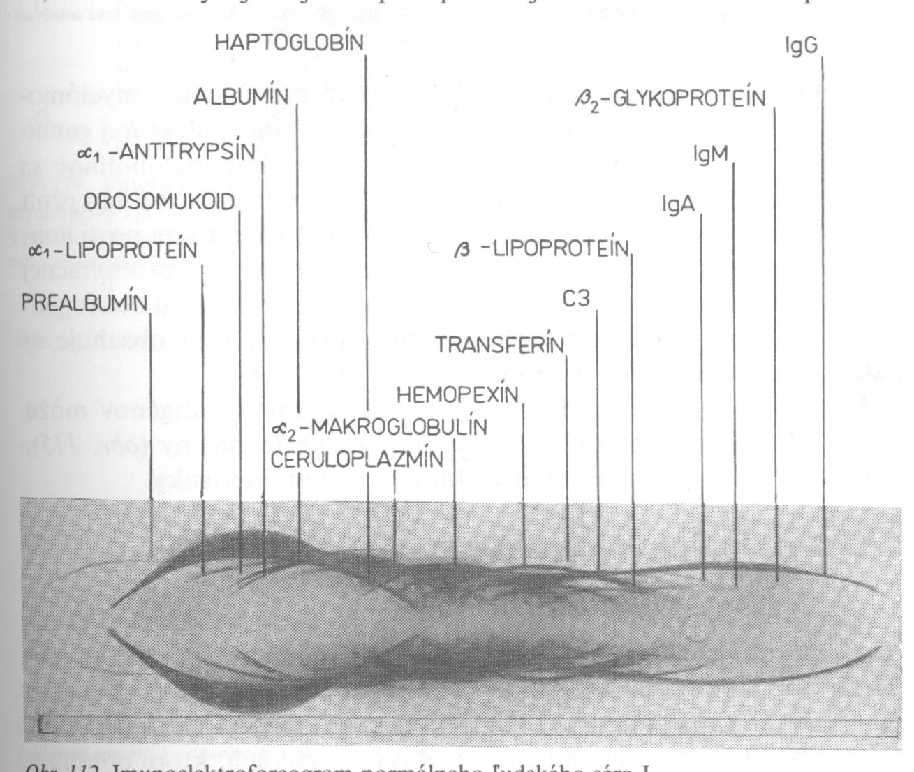 Imunoelektroforegram normálního lidského séra Ve žlábku