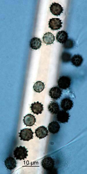 Aspergillus