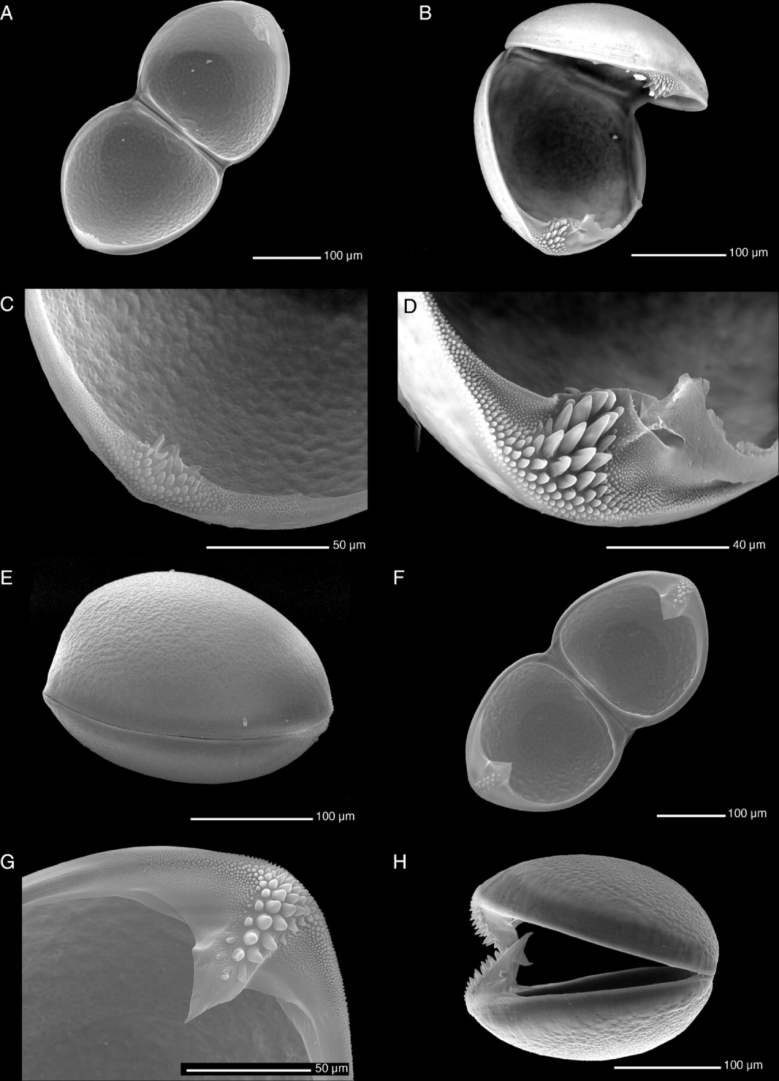 30 Příloha 7: Glochidium rodu Unio (U.