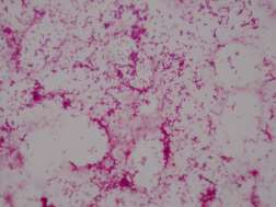Autotrofní denitrifikace Bakterie Thiobacillus denitrificans Betaproteobacteria G,
