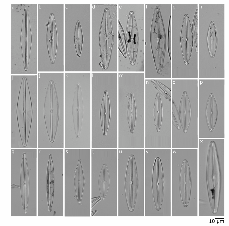 F. cf. magaliesmontana Cholnoky. Poslední izolovaný druh zatím nebyl formálně popsán a byl proto označen F. spa. (Obr.4 ). Obr.4 Morfologie druhů rodu Frustulia (LM). a-n) F.