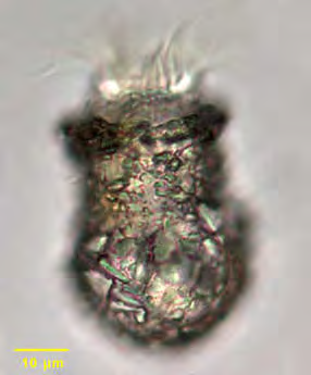 Codonella