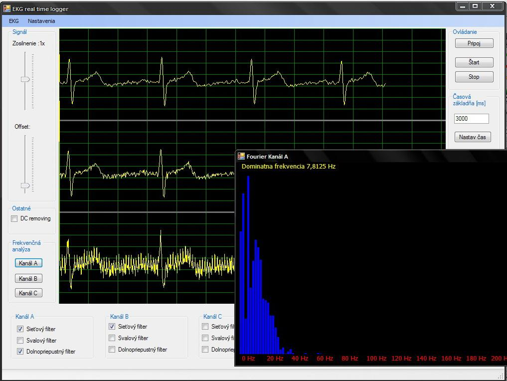 5.1 EKG Logger Základný prvok, vďaka ktorému je moţné prijímaný signál zobraziť v reálnom čase na monitore počítača.