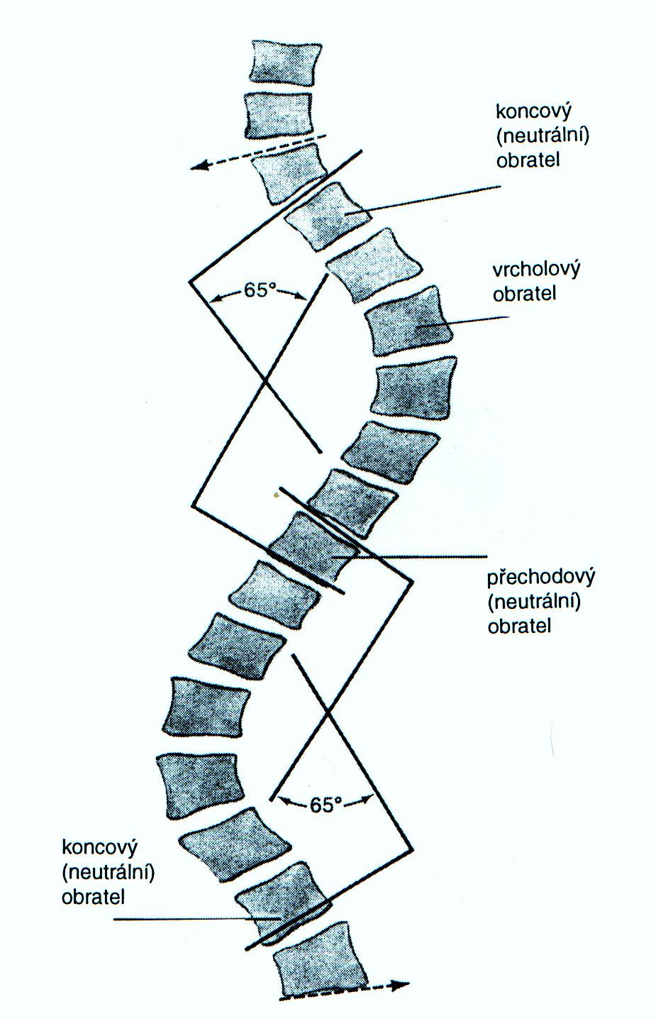Měření úhlu skoliózy dle Cobba Vrcholový obratel nejvíce vzdálen od