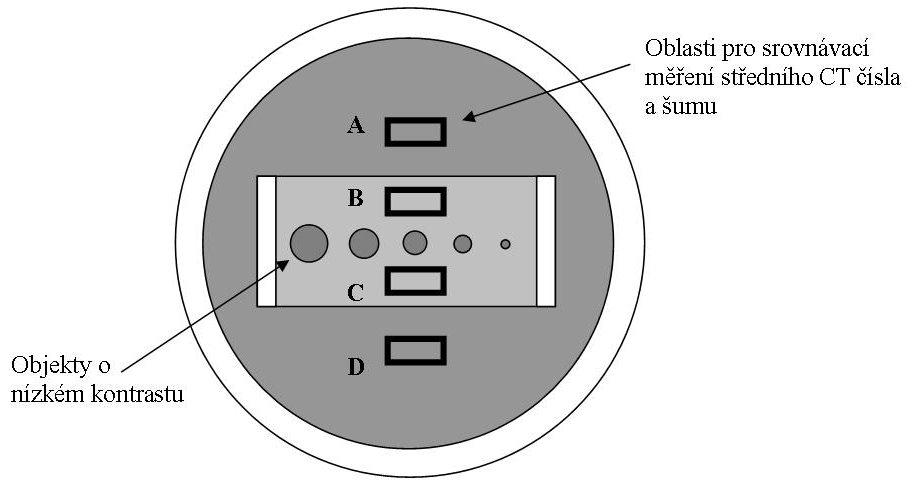 Důleţitým ukazatelem zobrazovací schopnosti CT přístroje je rozlišit od sebe struktury s nízkým kontrastem.
