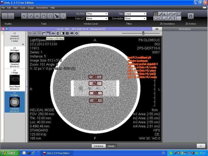 Při hodnocení se na monitoru zobrazí CT obrazy testovacího zařízení tak, aby byl kontrast mezi periodickými obrazci a pozadím dostatečný a stanovuje se, jaké nejmenší detaily jsou ještě rozlišitelné