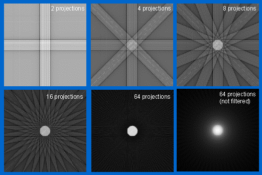 vyuţita u CT přístrojů uţ v 70. letech 20. Století.