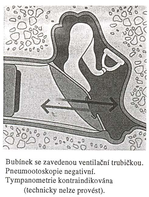 Zde je jejich přehled. [2] A.