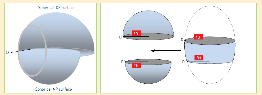 Progresivní čočky Bifokální čočka (vlevo) může vzniknout složením dvou sférických předních ploch větší poloměr