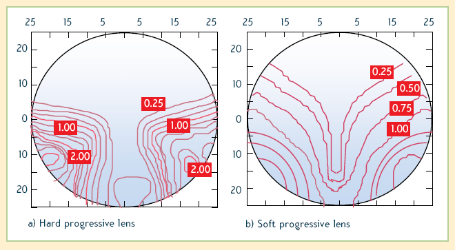 Progresivní čočky pokud designér zamýšlí získat velkou část pro vidění do dálky a vyšší hodnoty astigmatismu omezit pouze na dolní část čočky (odpovídá starší generaci čoček), je výsledkem tzv.