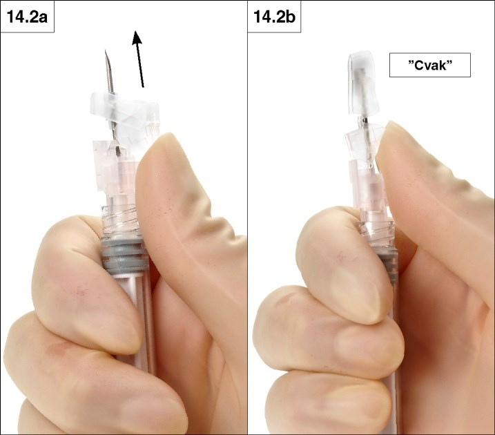 2. Uzavření palcem Přiložte palec na páčku a posuňte bezpečnostní krytku směrem k hrotu jehly (obrázky 14.2a a b). Krytka zakryje jehlu a uzamkne se.