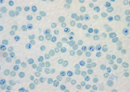 Počet retikulocytů Stanovení z krevního nátěru obarveného brilantkrezylovou modří (počet / 1000 RBC) (analyzátorem absolutní hodnoty)