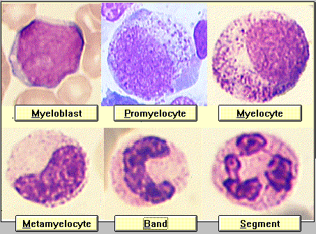 Počet leukocytů Udává se v množství x10 9 /l nebo x10 3 /µl