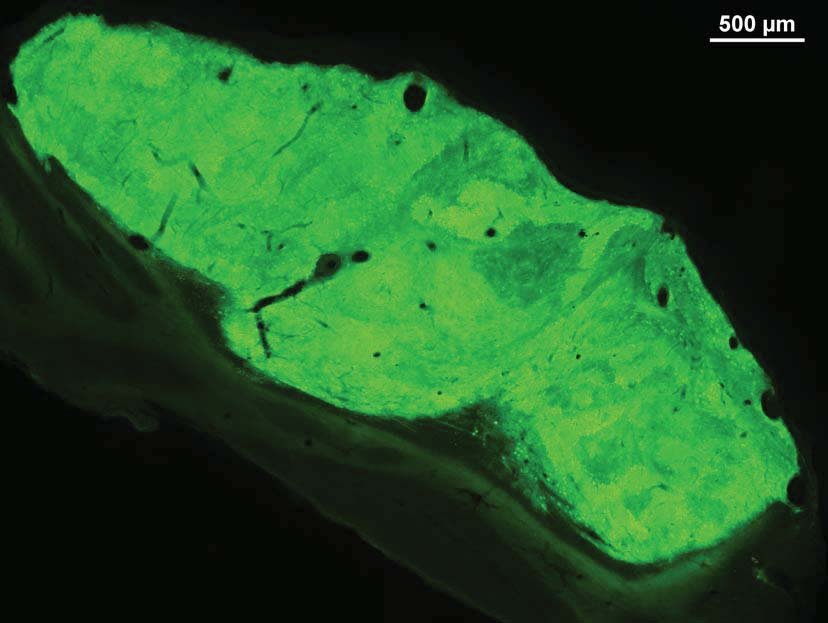 U n kterých zví at byl nalezen jen jeden transplantát. Jindy bylo nalezeno více menších kousk fluoreskující tkán (až p t) mnohdy od sebe zna n vzdálených.