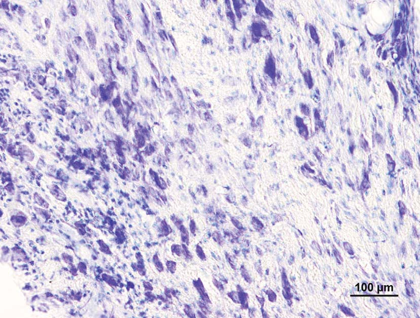Obr. 7: Transplantát bez charakteristického uspo ádání moze