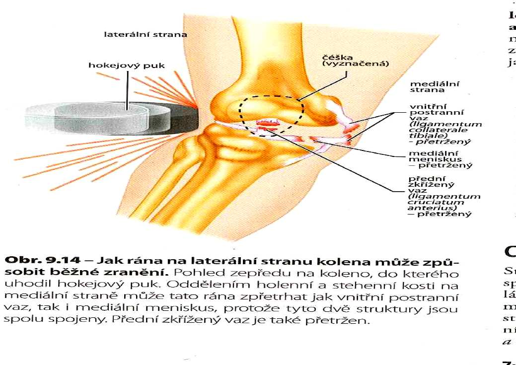 32 4. Transplantace osteochondrálních aloštěpů - výhodou je absence potíží z odběrového místa, rizikem je přenos chorob a imunitní reakce. 2.1.6.