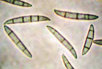 Zpravodaj ochrany lesa. Supplementum Konidie vybraných zástupců hub způsobujících padání semenáčků Fusarium sp. Pestalotia sp. Cylindrocarpon sp. Alternaria sp.
