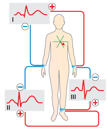 obraz srdce se nazývá svod. Jednotlivé svody poskytují odlišný pohled na srdeční elektrickou aktivitu, tedy i různé záznamy EKG [5, 6].