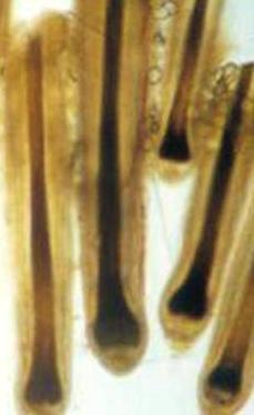 kůra dřeň kutikula Obr. : Struktura stvolu lidského vlasu.