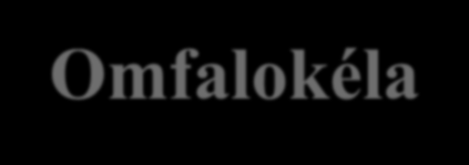 Omfalokéla v České republice, 1994-5 na 10 000 živě narozených 279 narození 436