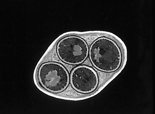 Kvasinky rozmnožování Pohlavní i nepohlavní Nepohlavní pučení a přehrádečné dělení Pohlavní konjugace haploidních buněk a vznik diploidní zygoty - Diploidní