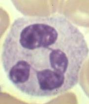 4. TEORETICKÁ ČÁST 4.1. Leukocyty Leukocyt bílá krvinka. Hlavní úlohou je schopnost ničit viry, bakterie, plísně, cizorodé částice, nádorově změněné buňky a všechny organismu cizí mikroorganismy. 4.1.1. Fyziologie bílých krvinek Leukocyt je bezbarvá buňka, většinou kulovitého tvaru a je stálou součástí krve.