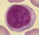 monocyty, plazmocyty) 4.1.3.