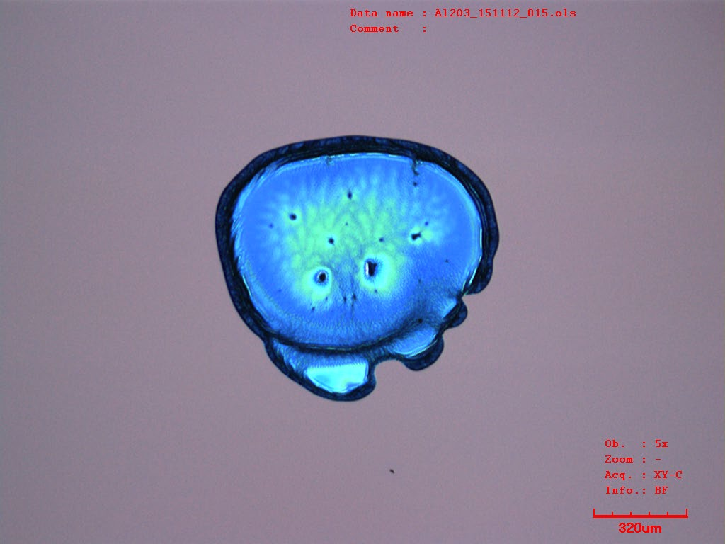 ultrazvuku (viz Obr. 3.13 a Obr. 3.14).